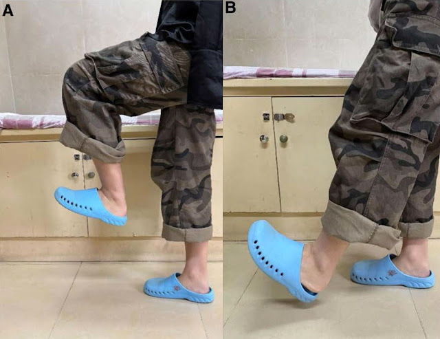 발꿈치 차기 운동으로 무릎 관절 기능을 개선하는 스트레칭 자세